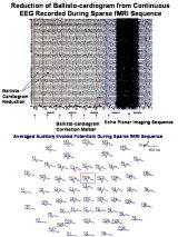 Neuroscan